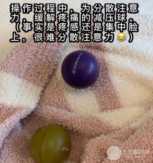 热玛吉真人体验过程记录