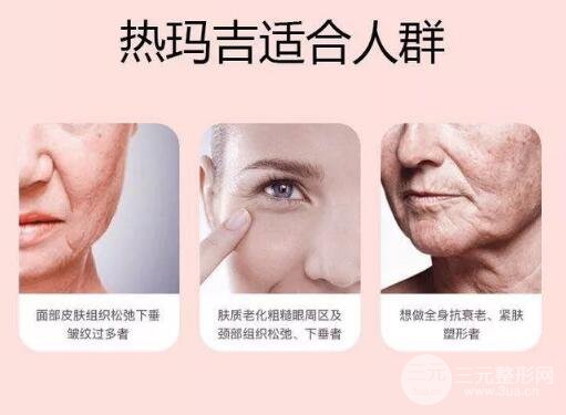 哪些的群体合适做第新一代热玛吉呢?