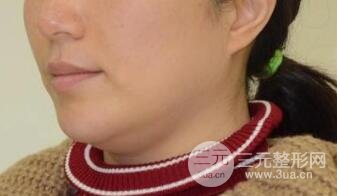 治疗前vs治疗后第一天