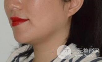 治疗前vs治疗后第一天