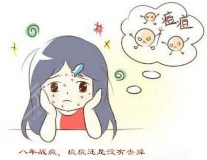 激光祛痘案例