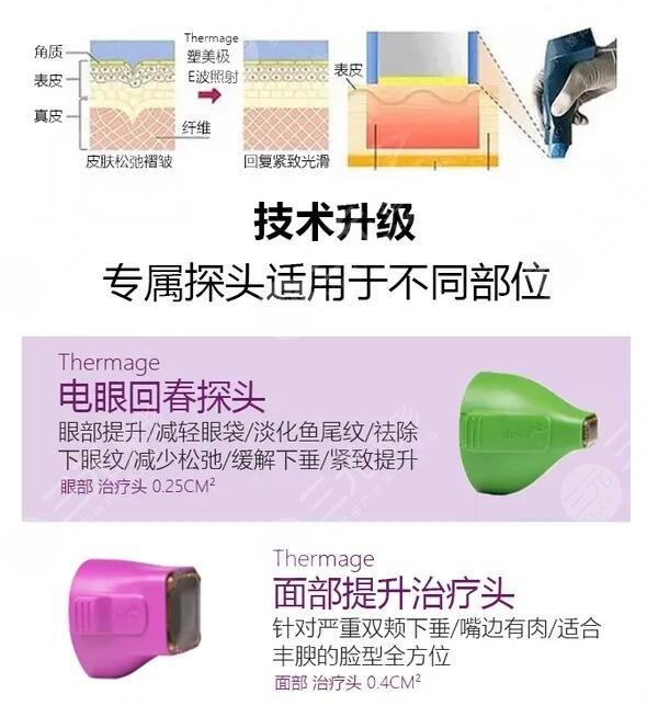 热玛吉技术