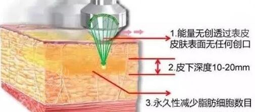超脂塑的原理