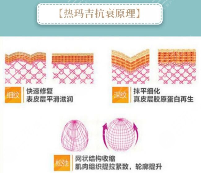 做热玛吉为什么不疼
