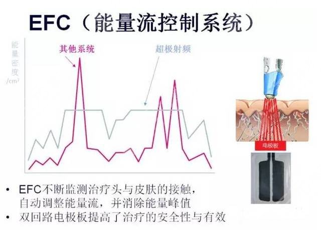 超脂塑溶脂比传统吸脂手术的优势