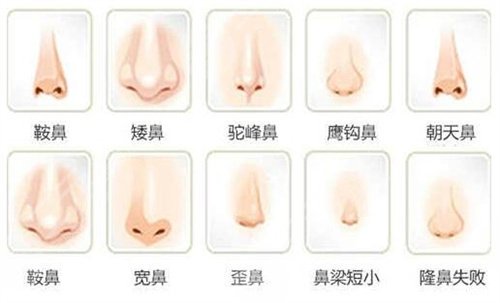 刘暾隆鼻案后果