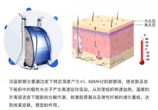 深蓝射频做一次有果吗?