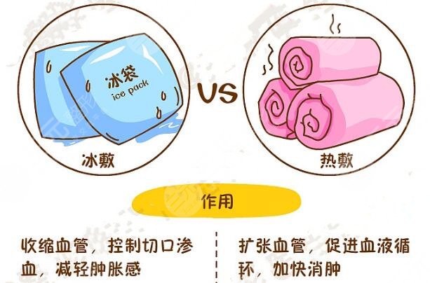 冰敷