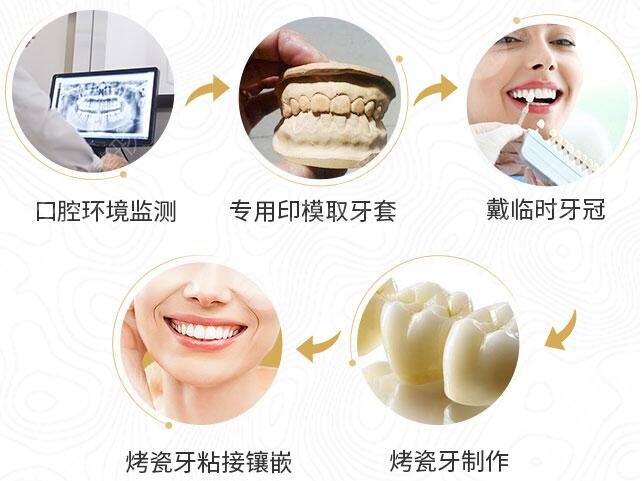 修复牙齿