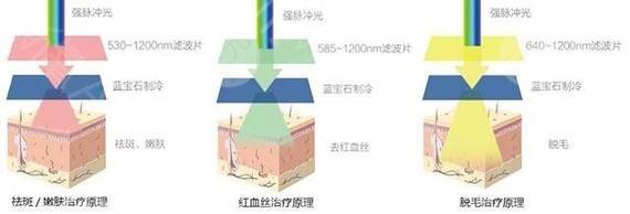 皮肤激光美容方式
