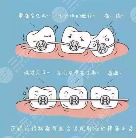 牙齿矫正的好处