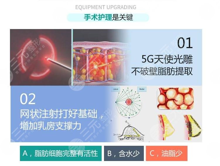 隆胸手术失败后