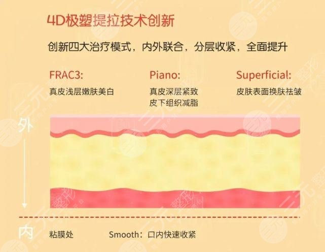 欧洲之星和热玛吉哪个好