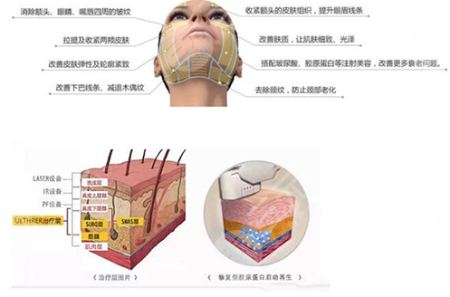 做热玛吉可以保持多久