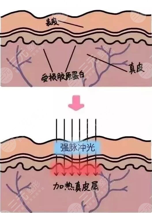 热玛吉作用