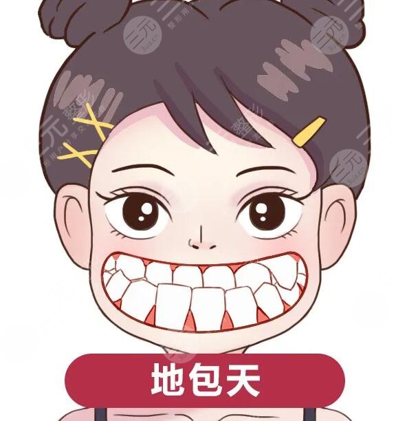做地包天矫正费用大概多少?“工薪族”能负担吗?地包天矫正前后对比