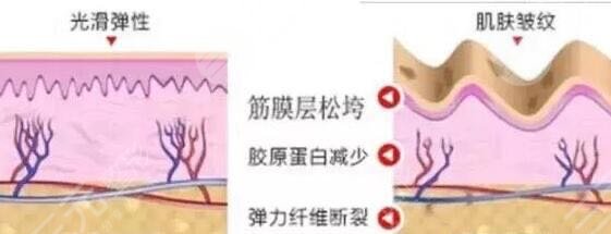 热玛吉一次多少钱?