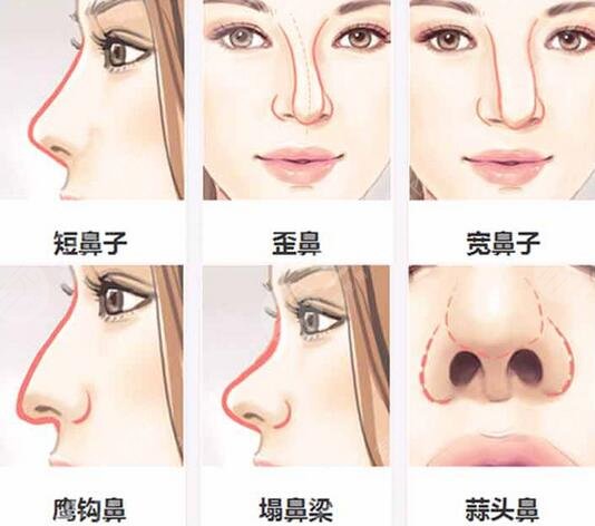 整形案例