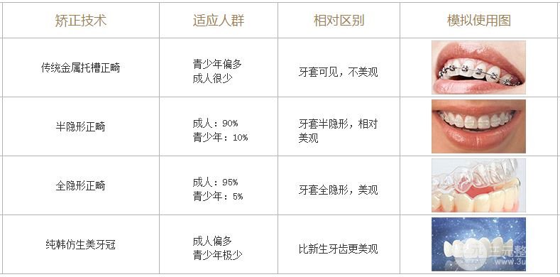 牙齿矫正有哪些