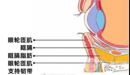 双眼皮科普
