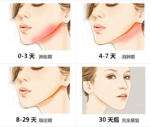 案例对比图