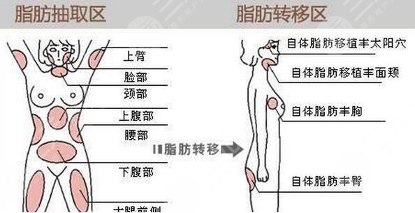林沸腾隆胸3个月果图