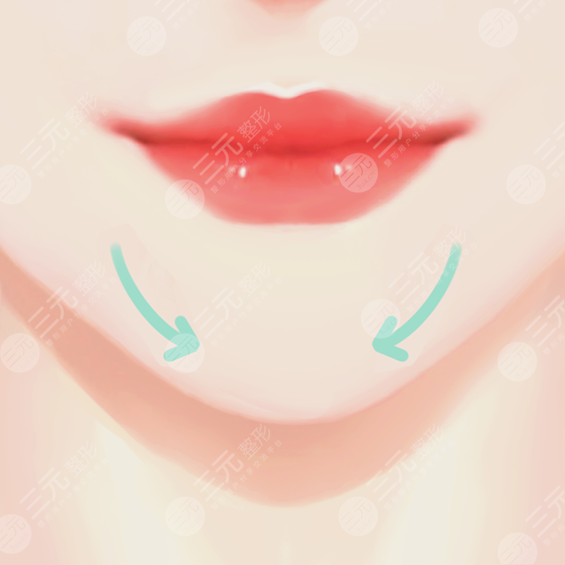 术后一个月果图