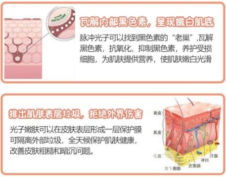 八大处光子嫩肤怎么样