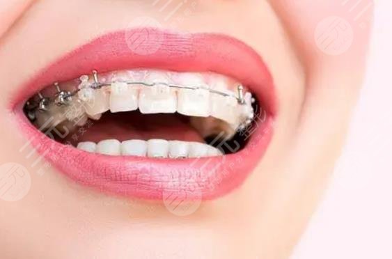 上海第九医院口腔科相关科普