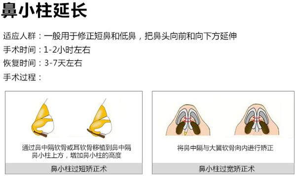 武汉肋骨鼻专家汪福强医生科普