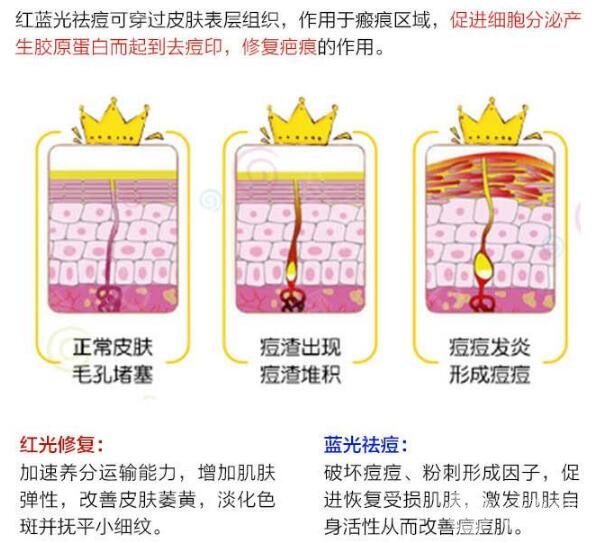 红蓝光