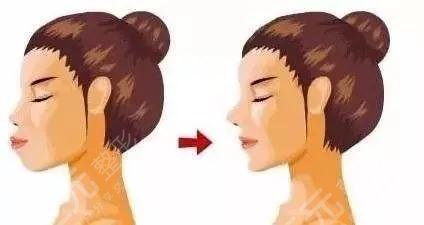 上海正颌手术费用