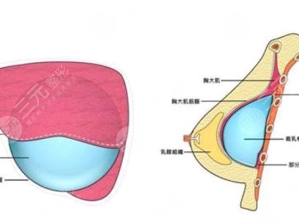 重庆隆胸医院