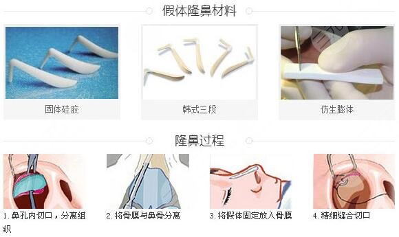 隆鼻术后当天