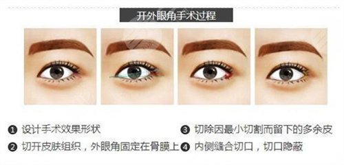 陈伟霆的颜值