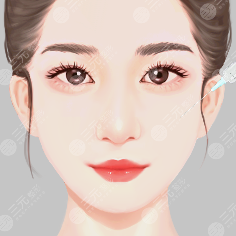 填充术后