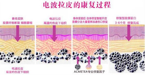 7d聚拉提做脸大概多久有果|真实案例图