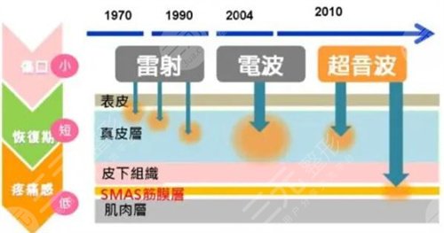 7d聚拉提做脸大概多久有果|真实案例图