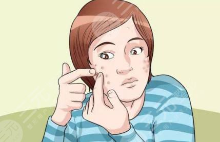 脸上有痘可以做fotona 4d吗?