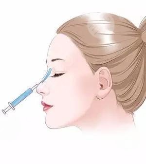 注射隆鼻有几种方法?注射胶原蛋白