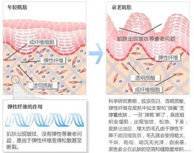 生物注射除皱价格是多少？收费受3个方面影响！