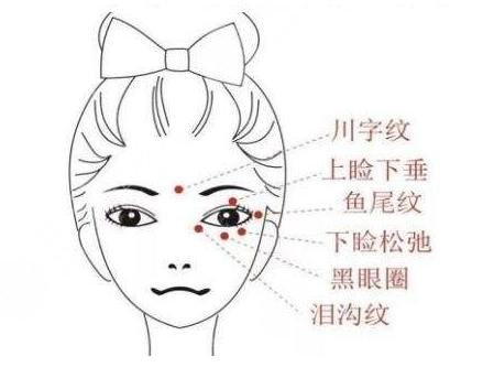 玻尿酸去除鱼尾纹的注意事项