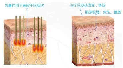 注意事项