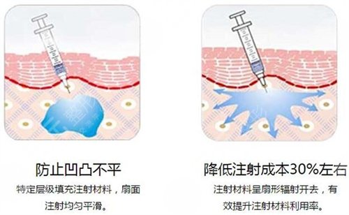301医院整形美容面部抗衰案例