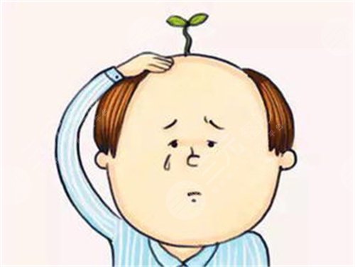 沈阳雍禾植发医院头发种植案例分享