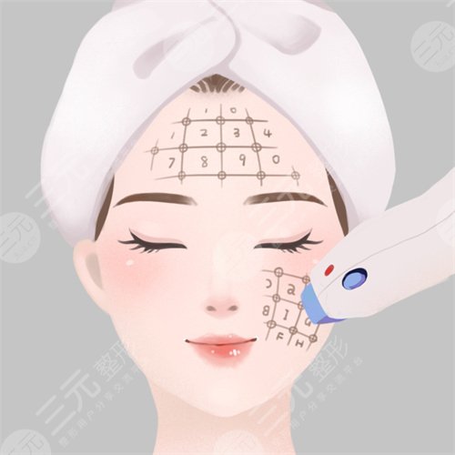 热玛吉半年做一次可以吗?适用人群有哪些?
