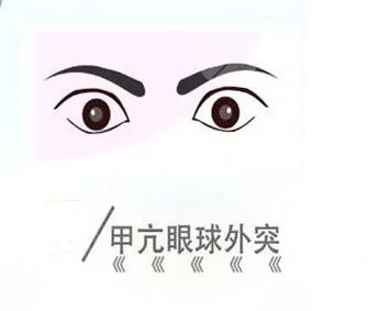 凸眼问题如何矫正?