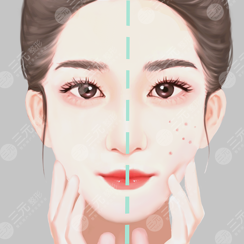 激光美肤术后果图