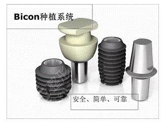 美国牙齿种植体品牌都各有哪些特点