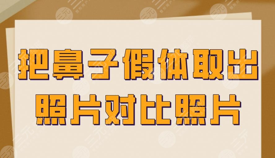 把鼻子假体取出照片对比照片！取出后还能恢复成隆鼻前吗？